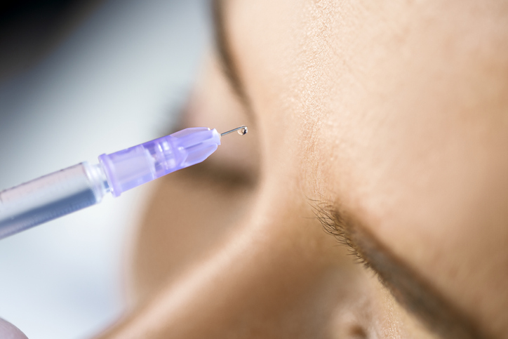 Survey: How Attitudes to Anti-Wrinkle Injectables and Fillers are Changing Across the World